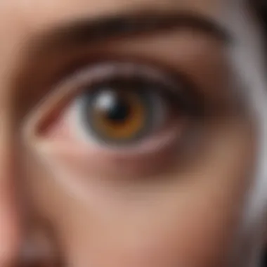 Graphic representation of sarcoidosis in the eyes