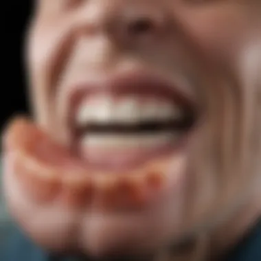 Materials Used in Dentures Comparison of materials used in dentures