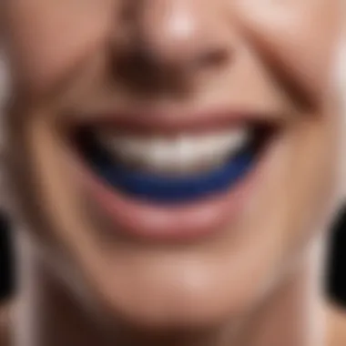 Fit of Cobalt Chrome Dentures Patient showcasing cobalt chrome denture fit