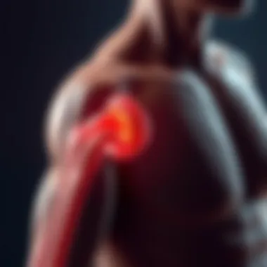 Muscular Atrophy in Rheumatoid Arthritis Diagram showing muscular atrophy linked to rheumatoid arthritis