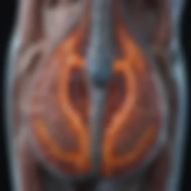 MRI Scan of Tethered Cord Syndrome A detailed MRI scan highlighting the characteristics of tethered cord syndrome.