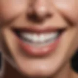 A close-up of a bright, white smile showcasing the results of teeth whitening.