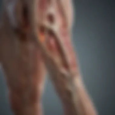Nerve Pathways and Leg Pain Diagram illustrating nerve pathways affected by surgery