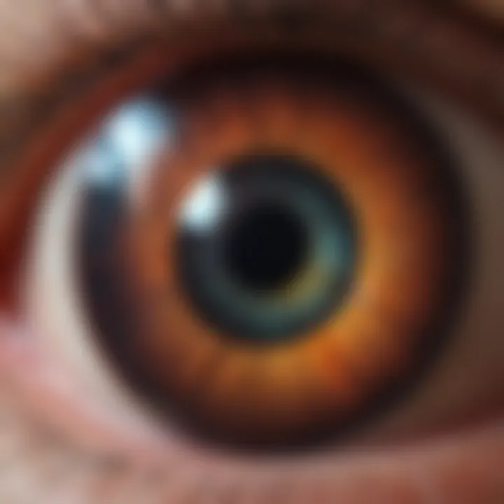 Detailed view of retinal degeneration in retinitis pigmentosa