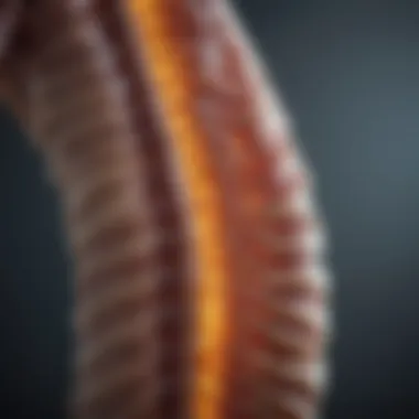 Spinal Lymphoma Impact on the Spinal Cord Illustration depicting spinal lymphoma affecting the spinal cord.