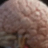 Illustration of the brain highlighting areas affected by ADHD and ASD