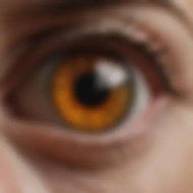 Diagram showing the causes of macular separation