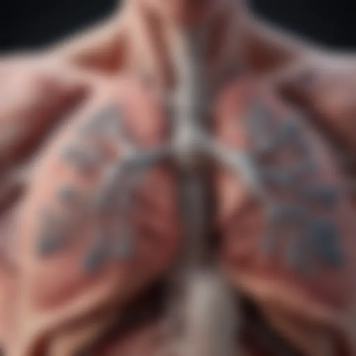 Illustration depicting the lungs affected by pneumonia