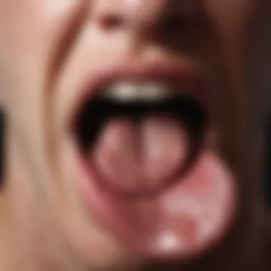Irritated Tongue Close-up Close-up of a tongue showing irritation