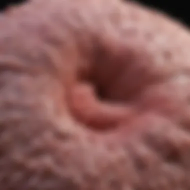Notable Understanding TTF 1 Adenocarcinoma: An In-Depth Review Notable Understanding TTF 1 Adenocarcinoma: An In-Depth Review